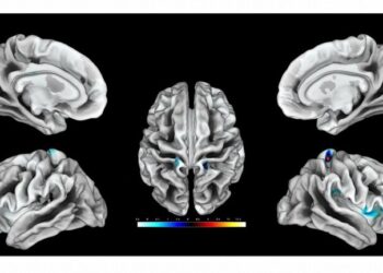 دراسة أمريكية تكشف عن مرحلة دماغية غريبة تسبق الوفاة