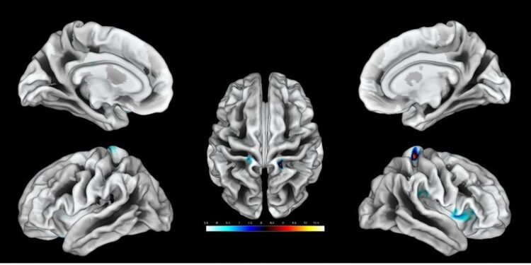 دراسة أمريكية تكشف عن مرحلة دماغية غريبة تسبق الوفاة