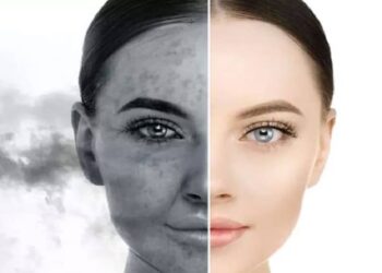 التلوث الهوائي أحد أهم أسباب الشيخوخة المبكرة ….. دراسة أميركية جديدة تؤكد ذلك