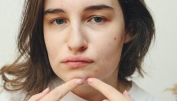 متلازمة تكيس المبايض …….مرض العصر